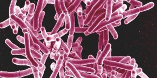 Nonprofit under pressure to make new TB drug affordable new drug, for hard-to-treat tuberculosis infections, drug-resistant